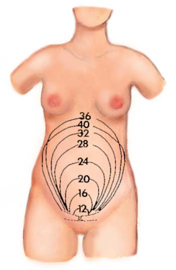 Kohdunpohjan korkeuden muutokset eri raskausviikoilla